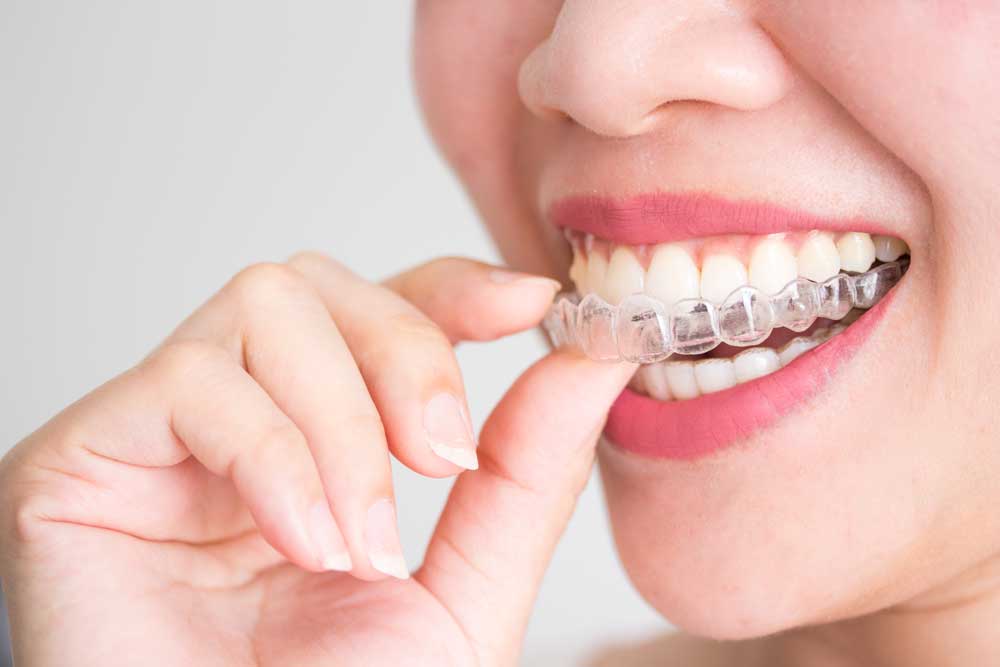 A woman adjusting her invisalign braces.
