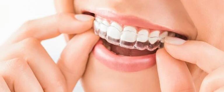Shelburne family dental Shelburne ON