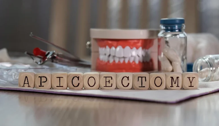 apicoectomy in Shelburne, ON