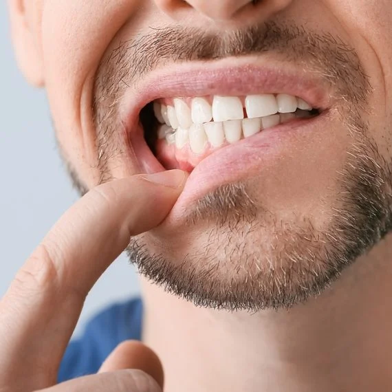 gum disease treatment in Shelburne