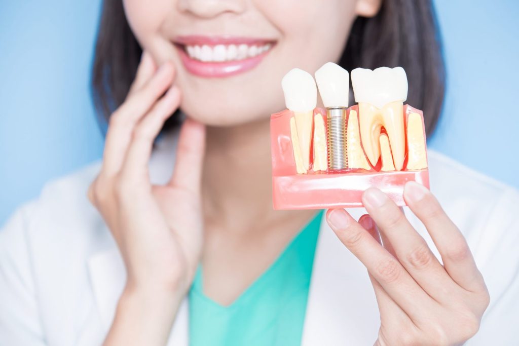 Smiling woman holding a dental implant model